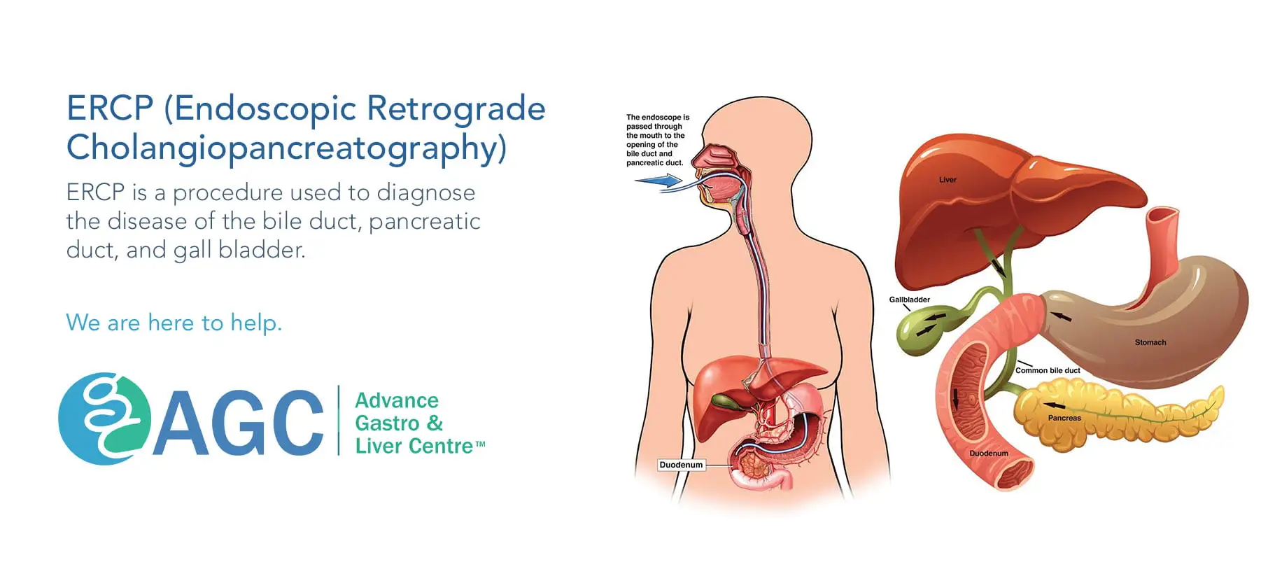 Endoscopic-Retrograde-Cholangiopancreatography