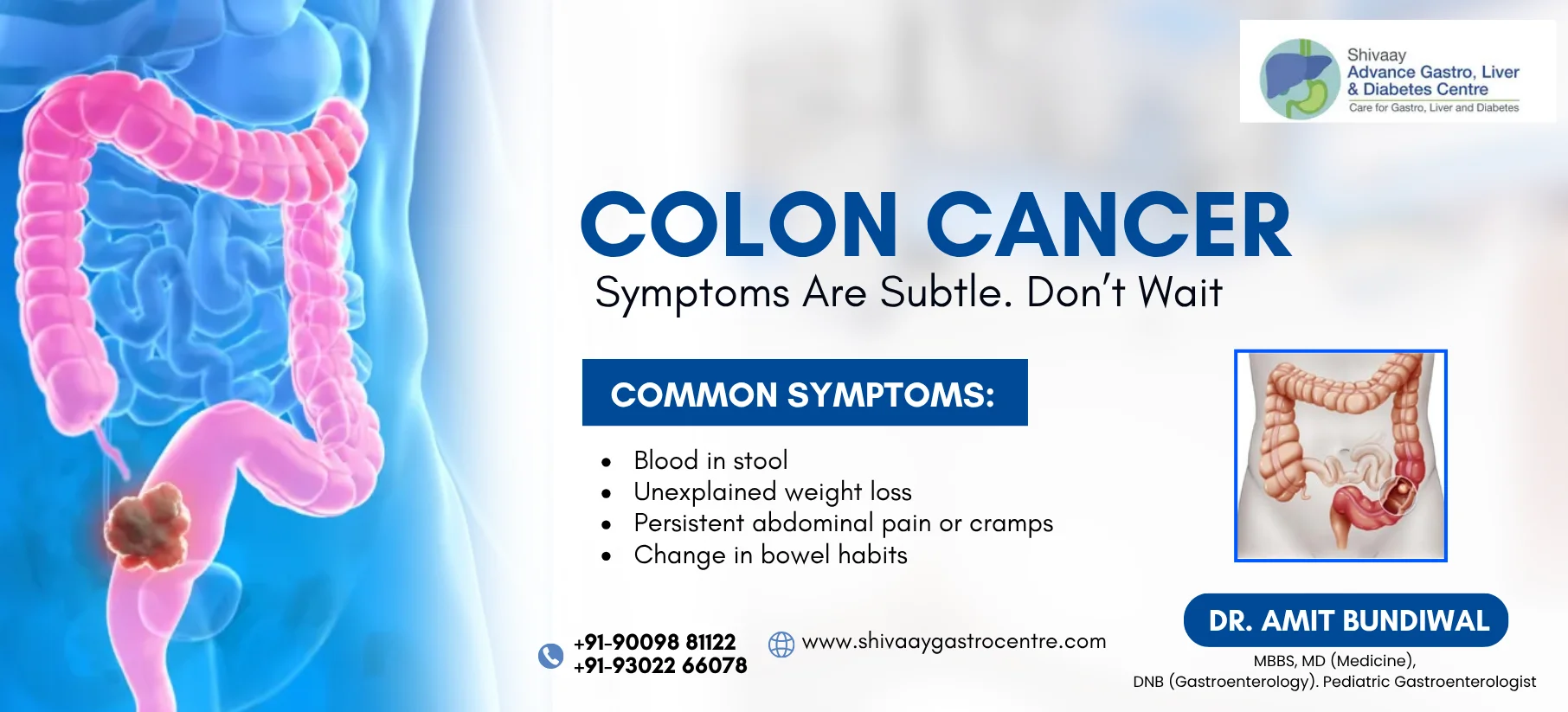colon cancer treatment at shivaay advance gastro centre