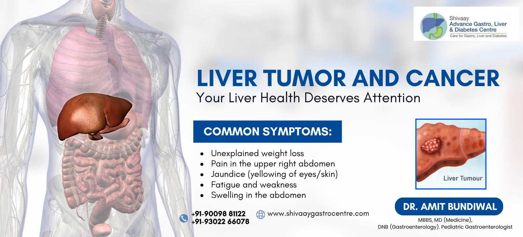 liver tumor and cancer treatment at shivaay advance gastro centre